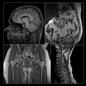 kokovartalon MRI (laaja) - Karelia Magneetti