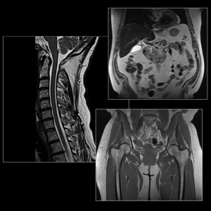 kokovartalon MRI (perus) - Karelia Magneetti