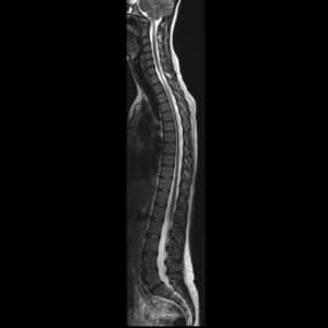 Koko selkärangan MRI, Karelia Magneetti